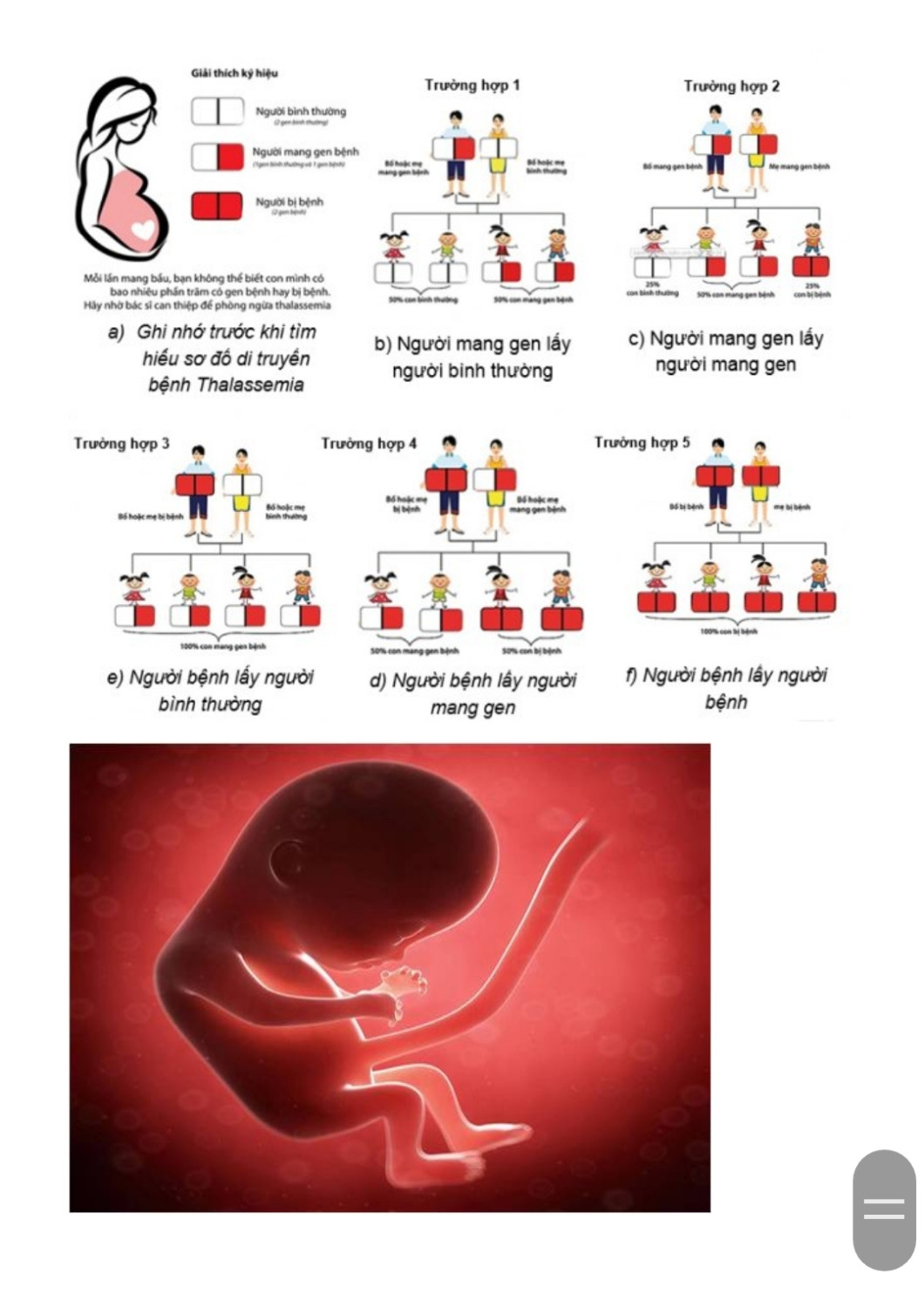 Hưởng ứng Ngày Thalassemia 8/5/2024